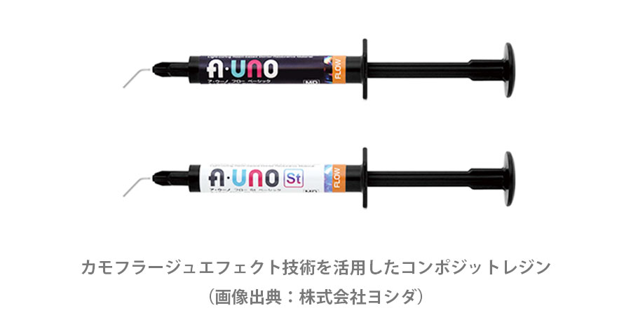 近年はより優れたコンポジットレジンが登場