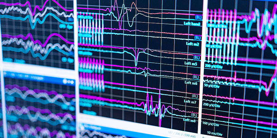 脳機能の調べ方~脳波の測定