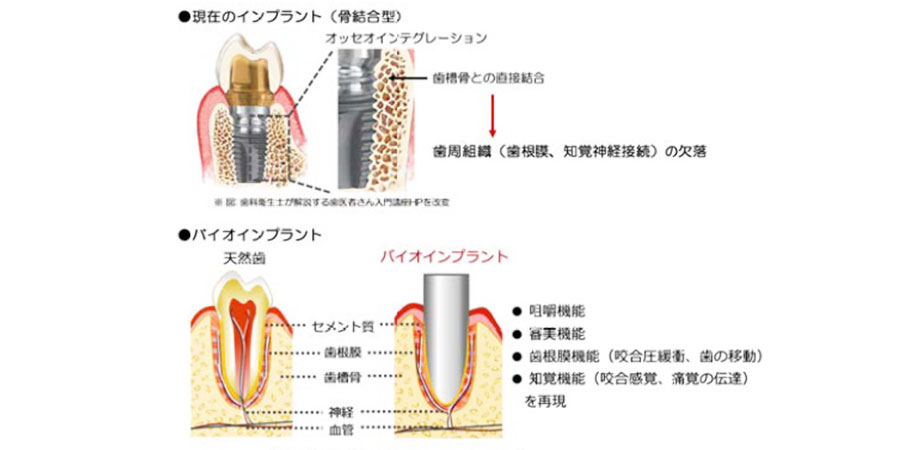 バイオインプラントが開く新たな可能性