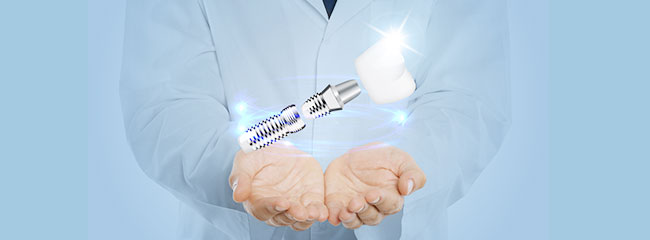 歴史を変えるかもしれない次世代インプラント『バイオインプラント』とは？