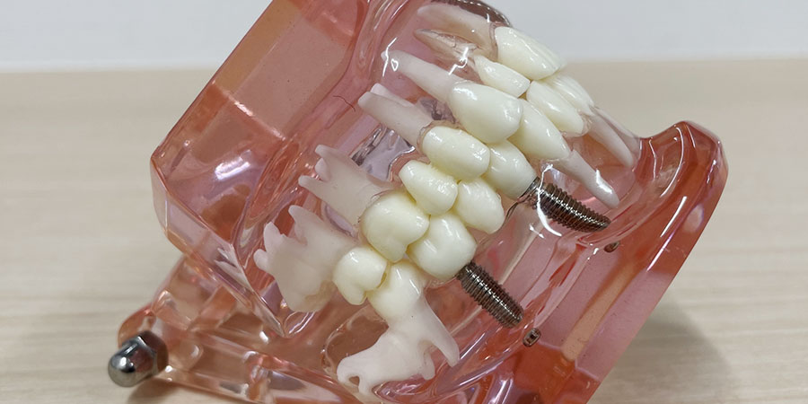 プラットフォームスイッチングとは